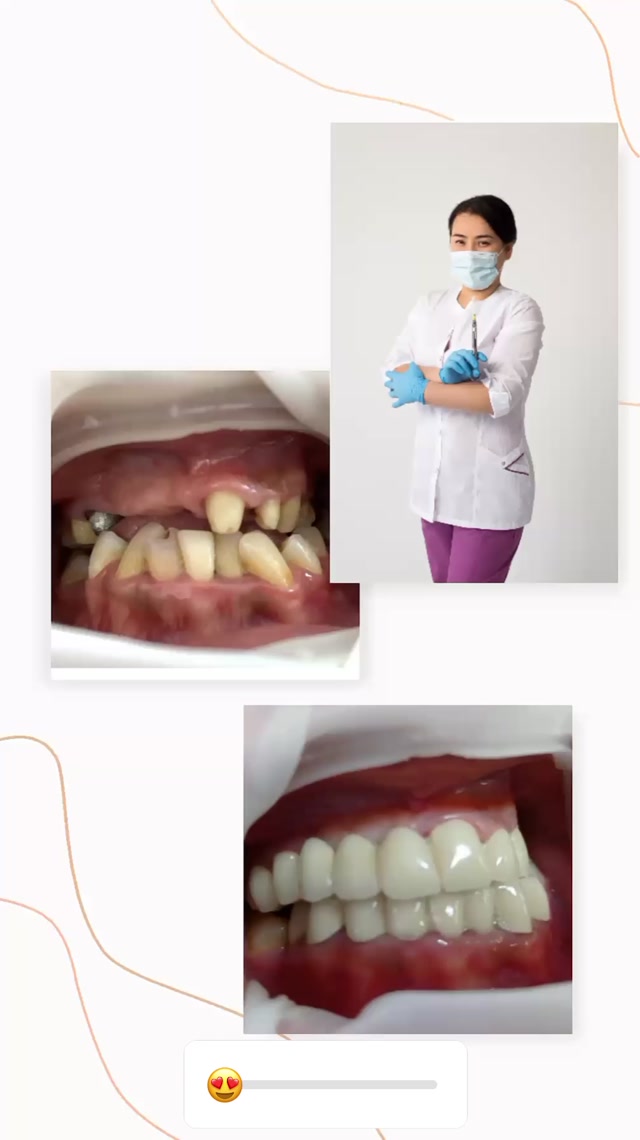 Лечение зубов