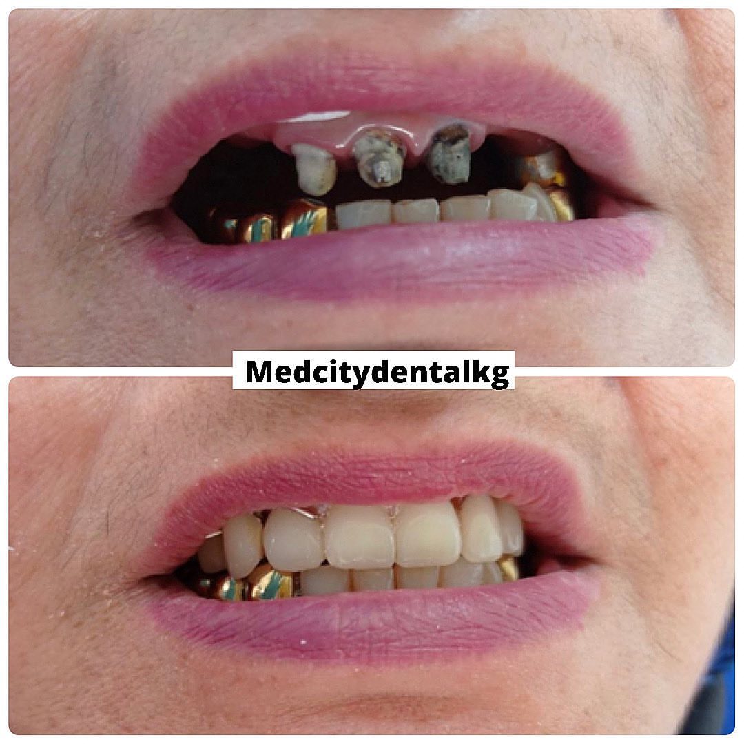 Бесплатная консультация